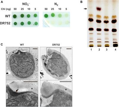 The Dual Role of the Glycolipid Envelope in Different Cell Types of the Multicellular Cyanobacterium Anabaena variabilis ATCC 29413